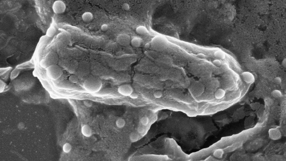 Proponen una nueva estrategia para eliminar bacterias multirresistentes