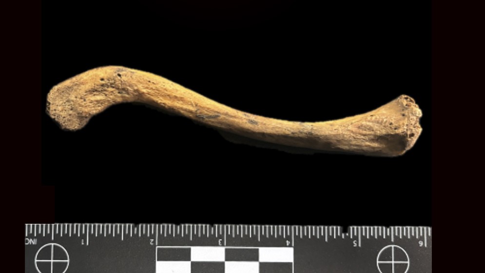 Encuentran la evidencia más antigua del mundo de la acción de una bacteria responsable de múltiples enfermedades
