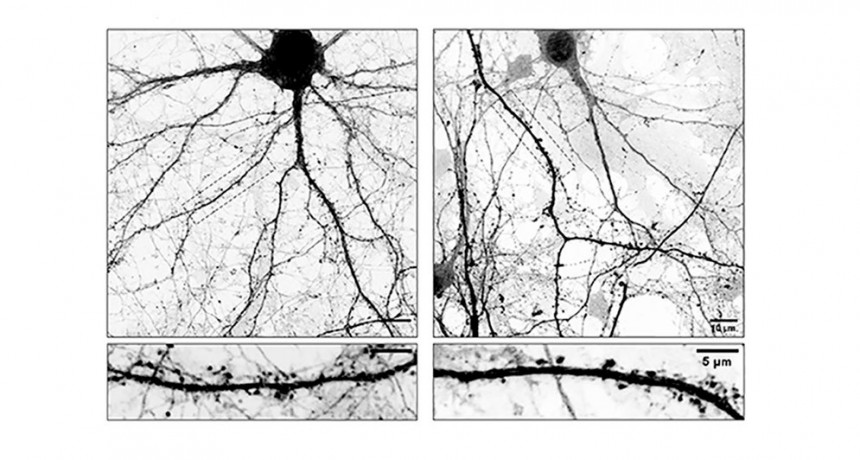 Develan mecanismos que podrían abrir un camino hacia la optimización de las terapias contra el Parkinson