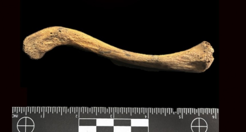 Encuentran la evidencia más antigua del mundo de la acción de una bacteria responsable de múltiples enfermedades