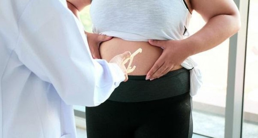 “El punto de partida es definir la obesidad como una enfermedad”