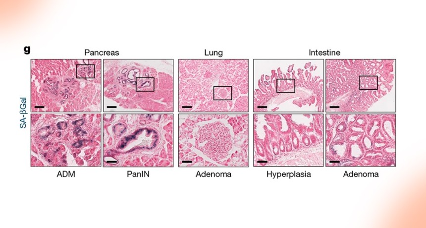 Elaboran el primer atlas de l&iacute;neas celulares de c&aacute;ncer de rat&oacute;n