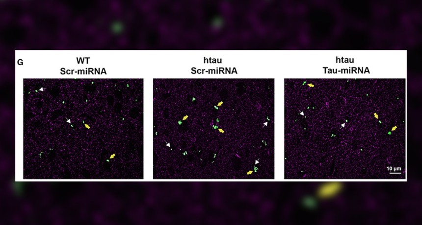 Cient&iacute;ficas del CONICET avanzan en el desarrollo de una terapia innovadora para enfermedades neurodegenerativas