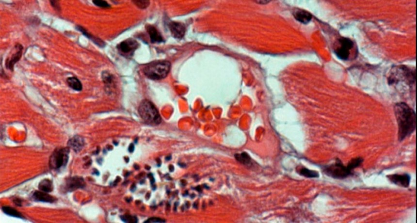 Enfermedad de Chagas: un desafío multidimensional