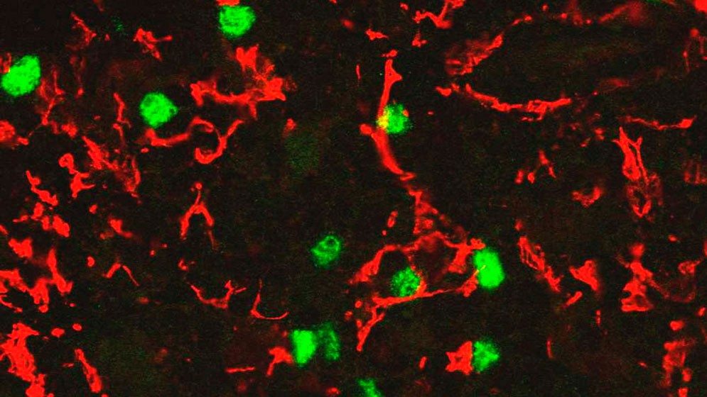 La inmunolog&iacute;a: un sentido que percibe y responde al entorno