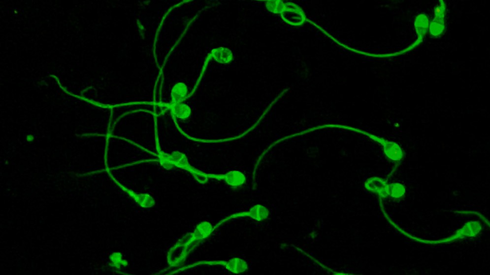 Tecnología desarrollada por investigadores del CONICET logra aumentar tasas de éxito de reproducción asistida en estudios preclínicos y clínicos