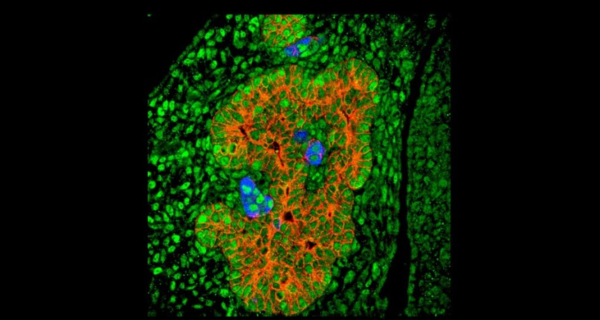 Diabetes tipo 1: nuevo hallazgo para generar células beta productoras de insulina con fines terapéuticos