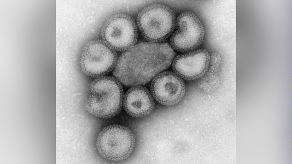 Identifican un potencial biomarcador para predecir la gravedad de la influenza en pacientes pediátricos