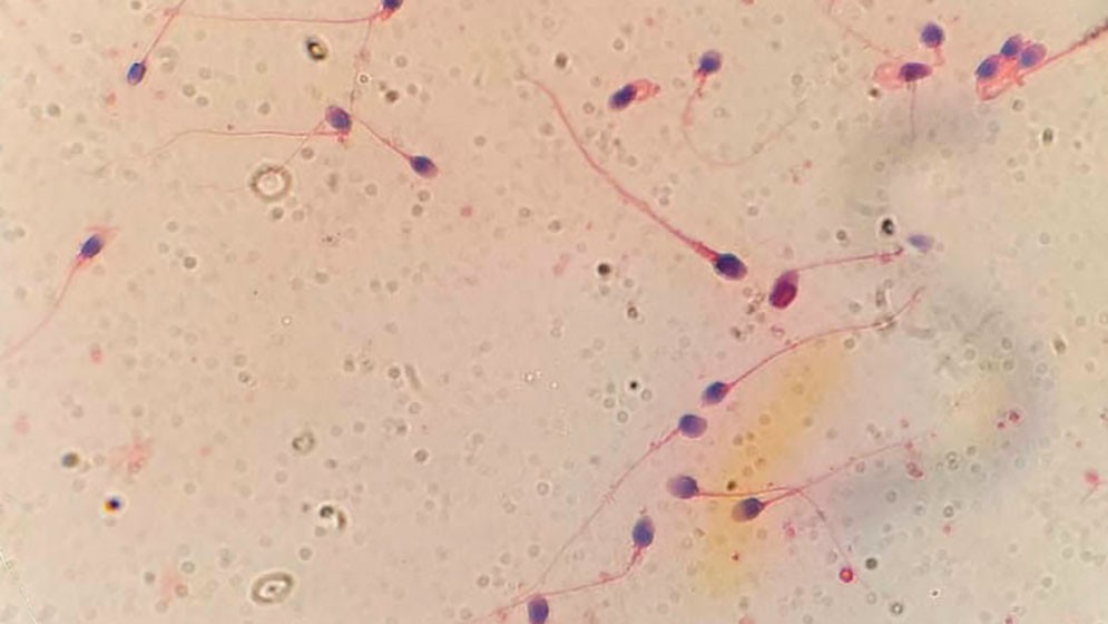 HyperSperm: la tecnolog&iacute;a de capacitaci&oacute;n esperm&aacute;tica creada por cient&iacute;ficos del CONICET avanza hacia la mejora de las tasas de embarazo en fertilizaci&oacute;n in vitro