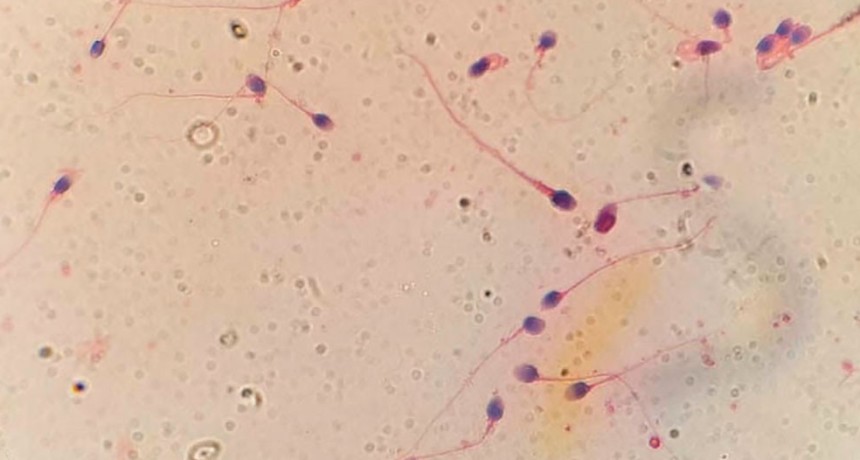 HyperSperm: la tecnolog&iacute;a de capacitaci&oacute;n esperm&aacute;tica creada por cient&iacute;ficos del CONICET avanza hacia la mejora de las tasas de embarazo en fertilizaci&oacute;n in vitro