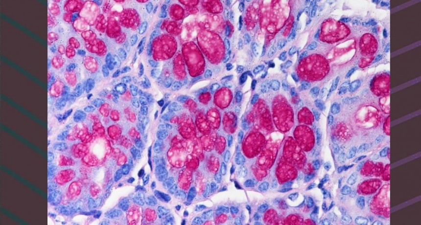 Descubren circuitos inmunológicos claves en enfermedades intestinales