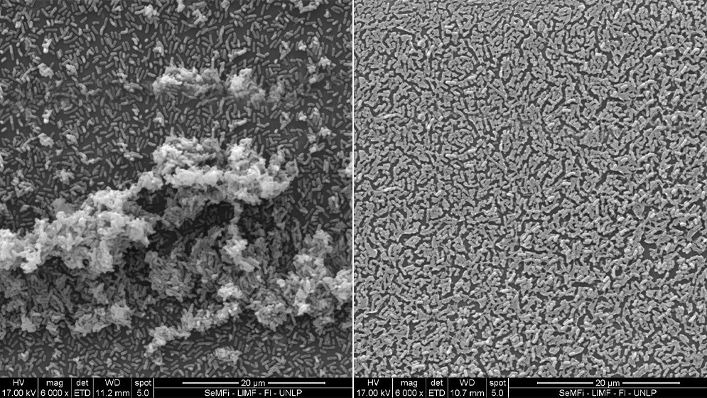 Describen la acción de dos sustancias para frenar la infección por una bacteria respiratoria