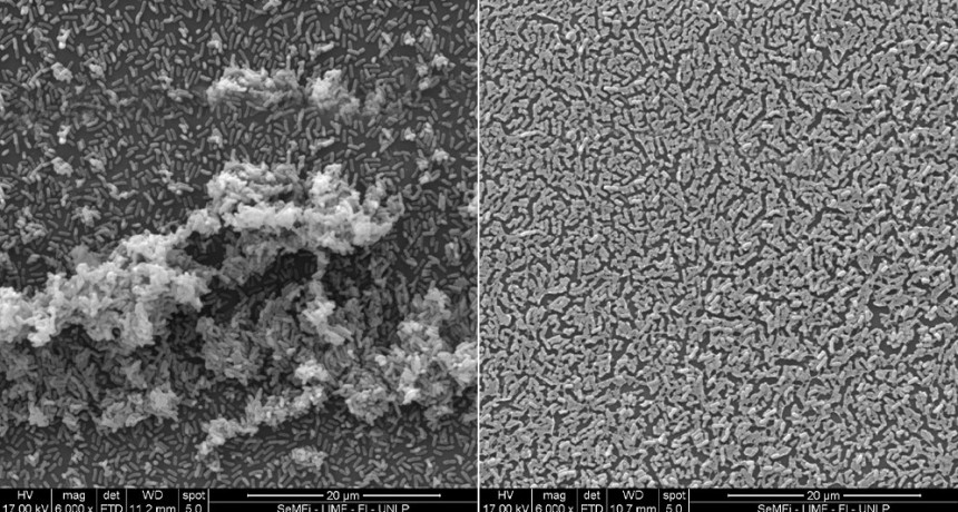 Describen la acción de dos sustancias para frenar la infección por una bacteria respiratoria