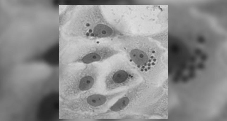 Descubren un potencial blanco farmacológico para tratar la enfermedad de Chagas