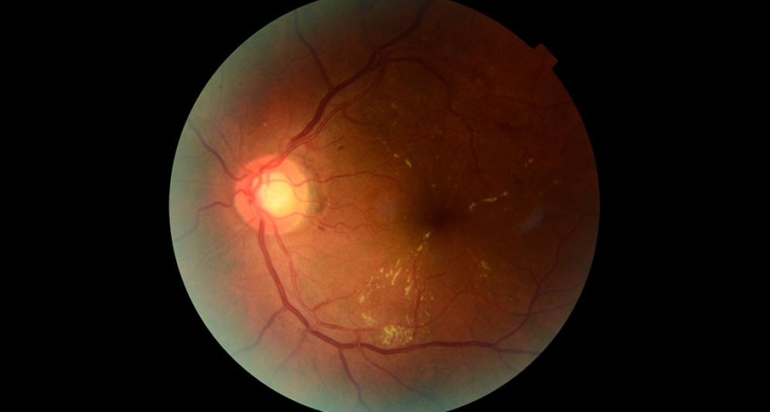 Retinar: la inteligencia artificial desarrollada por investigadores del CONICET que busca prevenir la p&eacute;rdida visual en personas con diabetes