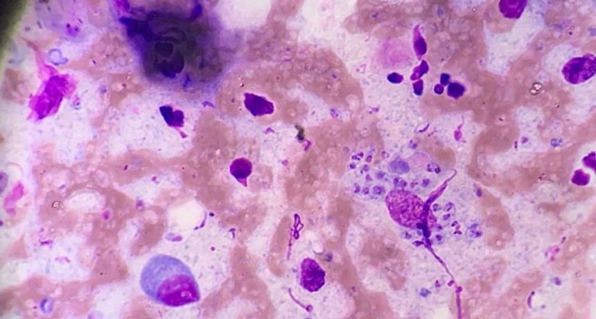 Desarrollan estrategia molecular para mejorar el diagn&oacute;stico de las leishmaniasis