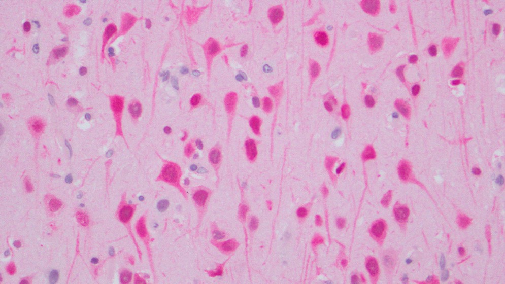 Determinan c&oacute;mo act&uacute;a el virus de la Influenza Aviar H5N1 en mam&iacute;feros marinos y confirman su transmisi&oacute;n placentaria