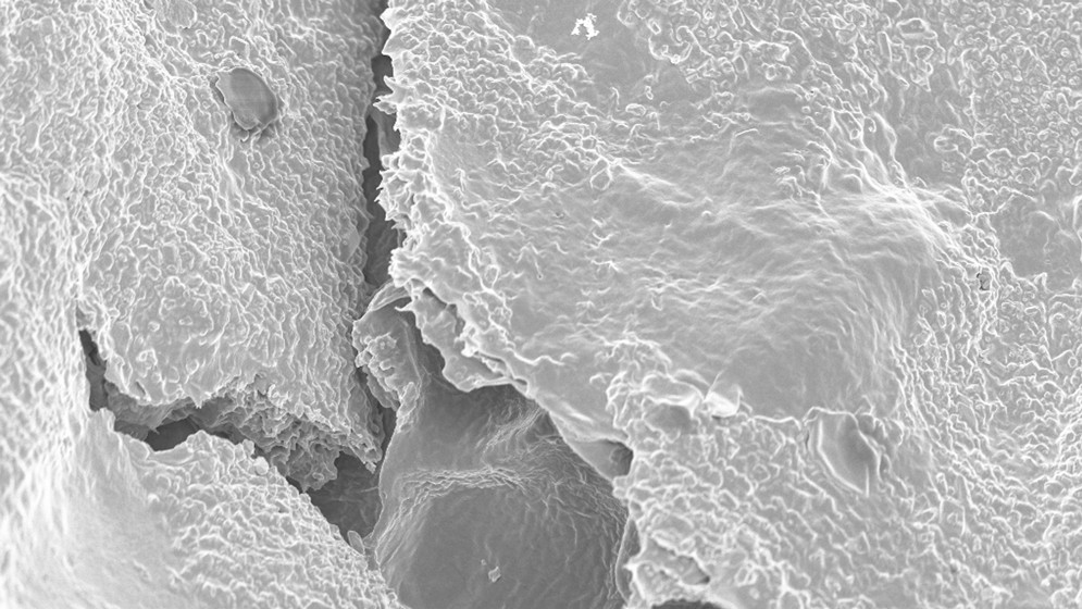Investigadores del CONICET trabajan en la optimizaci&oacute;n de un tratamiento contra el glaucoma