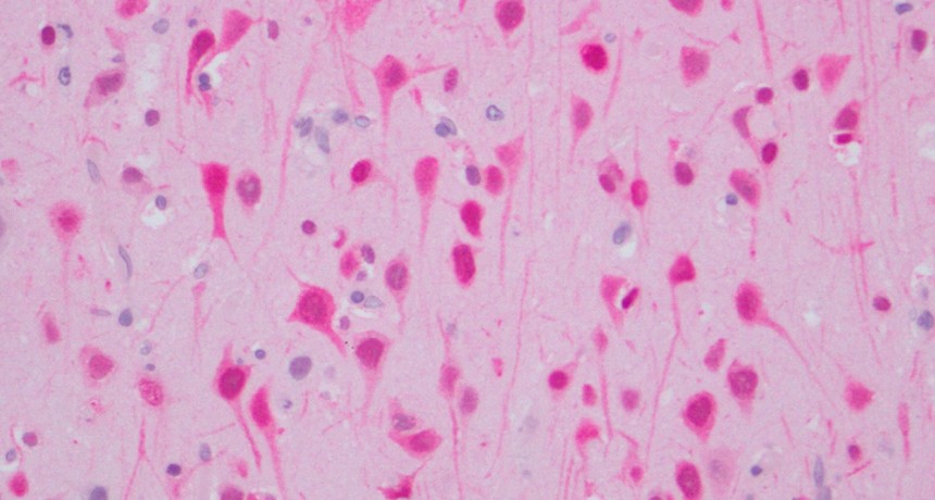 Determinan c&oacute;mo act&uacute;a el virus de la Influenza Aviar H5N1 en mam&iacute;feros marinos y confirman su transmisi&oacute;n placentaria