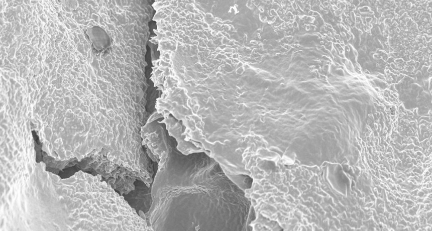 Investigadores del CONICET trabajan en la optimizaci&oacute;n de un tratamiento contra el glaucoma