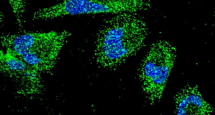 Descubren c&oacute;mo se comunican las c&eacute;lulas del c&aacute;ncer pancre&aacute;tico m&aacute;s frecuente para sobrevivir a condiciones adversas