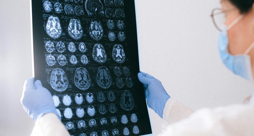 Identifican en sangre biomarcadores relevantes para el diagnóstico y el seguimiento de pacientes con epilepsia