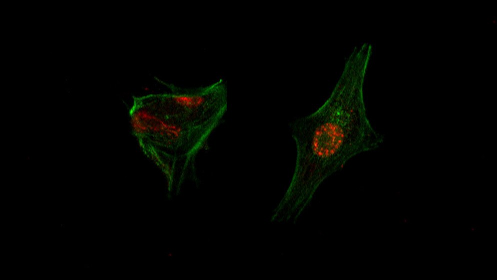 Estudio preclínico: con un enfoque pionero logran eliminar la metástasis de cáncer colorrectal