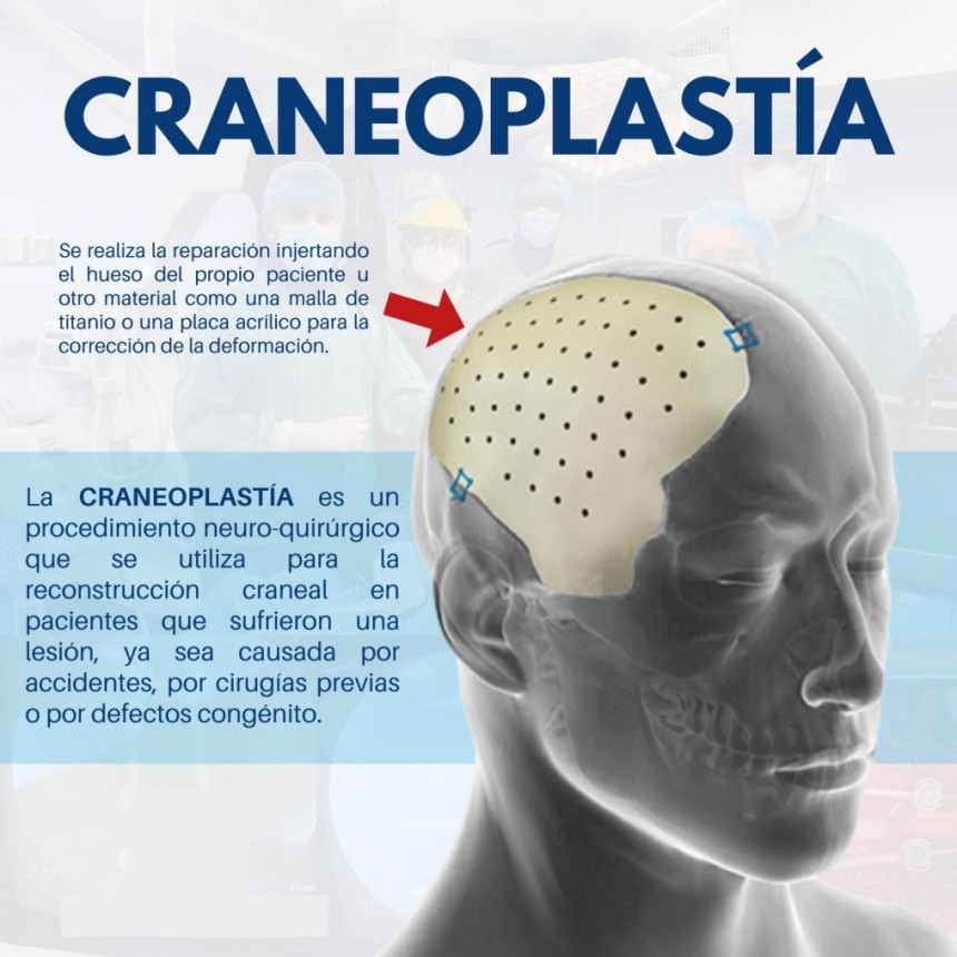 Histórico: realizaron la primera cirugía neuroquirúrgica en el Hospital Municipal de Miramar