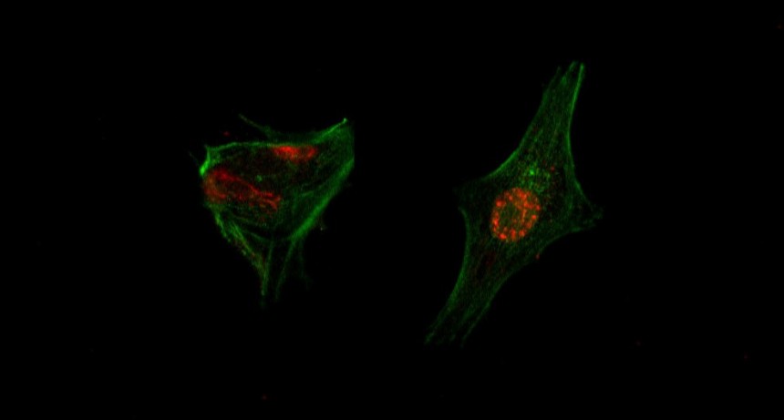 Estudio preclínico: con un enfoque pionero logran eliminar la metástasis de cáncer colorrectal