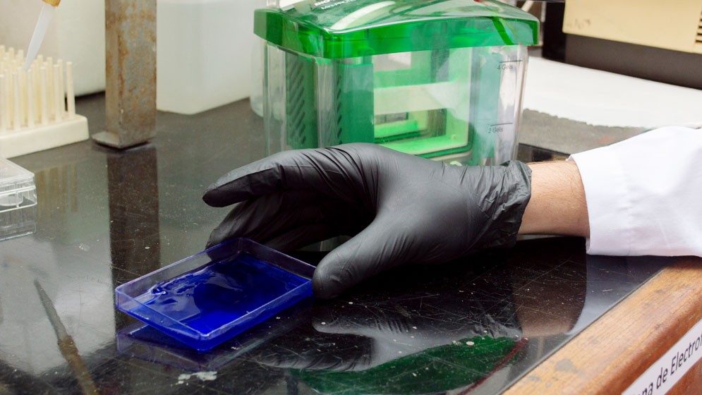 Identifican la falla en una proteína del colesterol “bueno” que predispone al riesgo cardiovascular